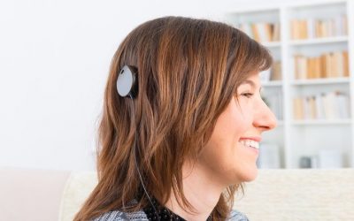 Cochlear Implants FAQ